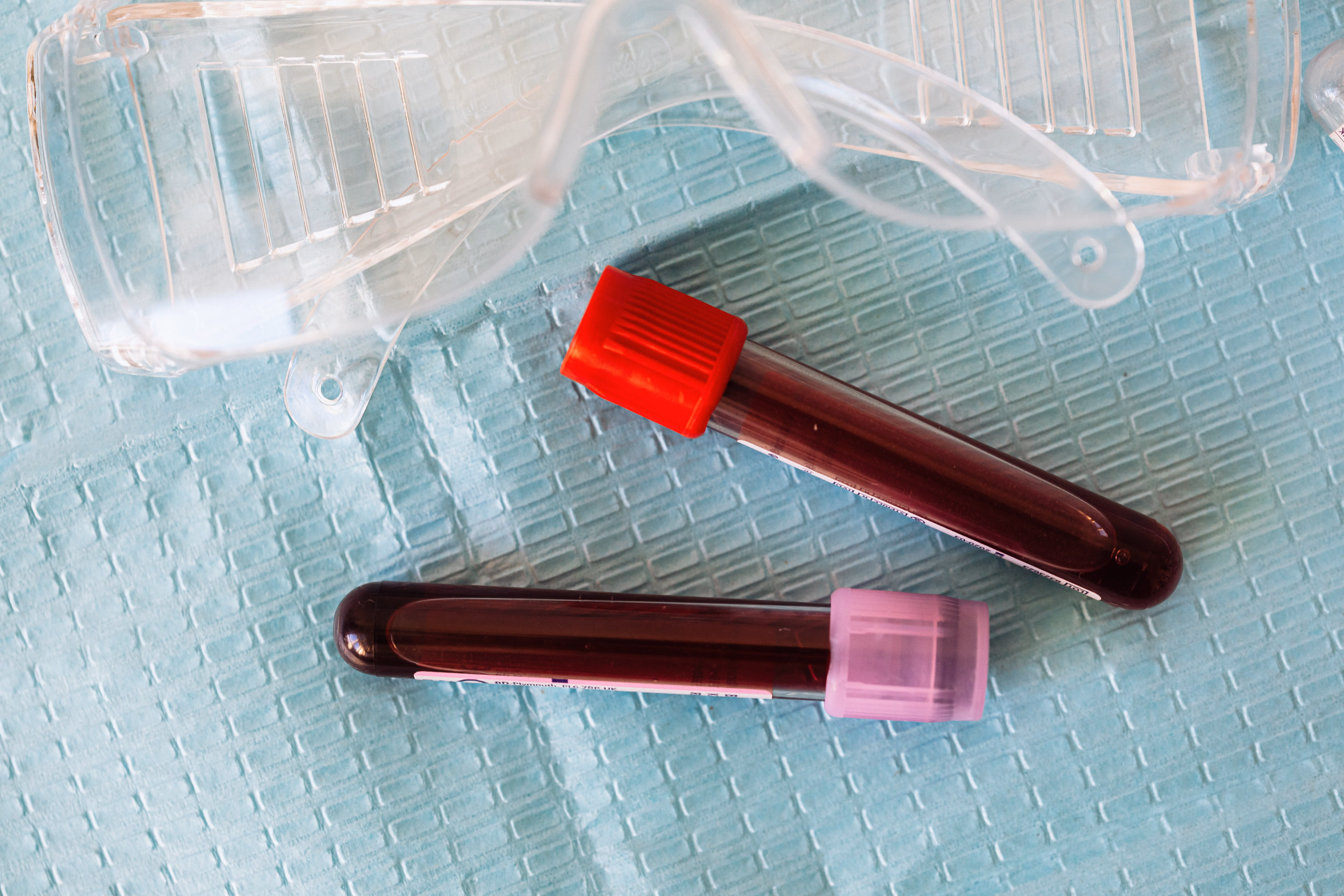 Blood Test Could Speed Lymphoma Diagnosis in Resource-Limited Settings